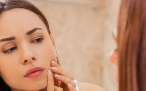 What Are the Best Treatments for Acne?