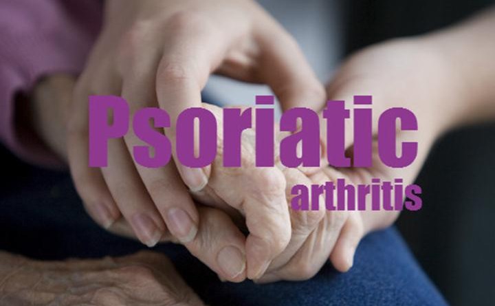 psoriatic arthritis treatment, psoriatic arthritis medications, treatment for psoriatic arthritis