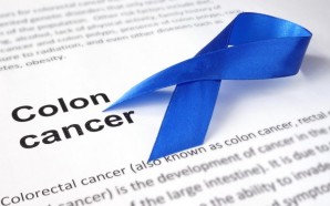 The Stages of Colon Cancer