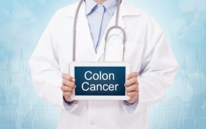 What you Should Know About Colon Cancer