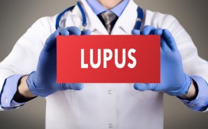 Treatment of Lupus