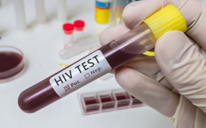 HIV Tests