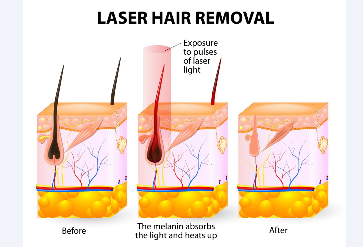 Causes of Hair Loss or Thinning Hair